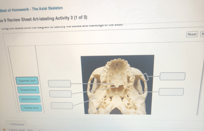 The axial skeleton review sheet exercise 8