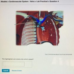 Pal models endocrine system lab practical question 11