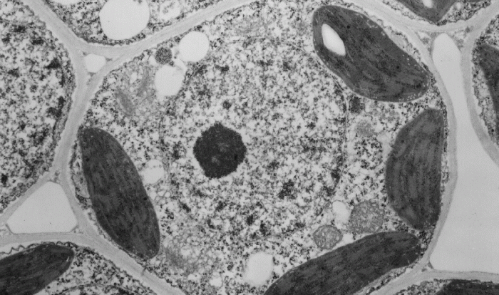 Label the transmission electron micrograph of the cell