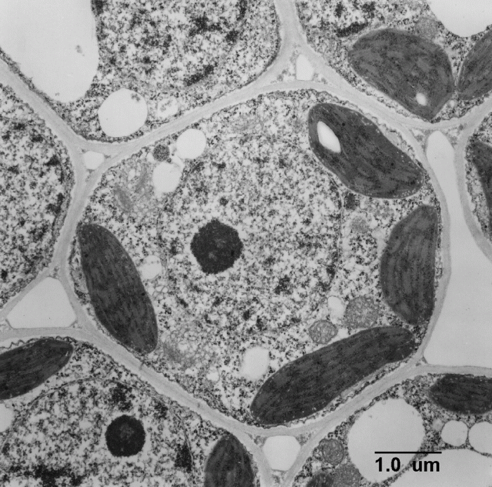 Label the transmission electron micrograph of the cell