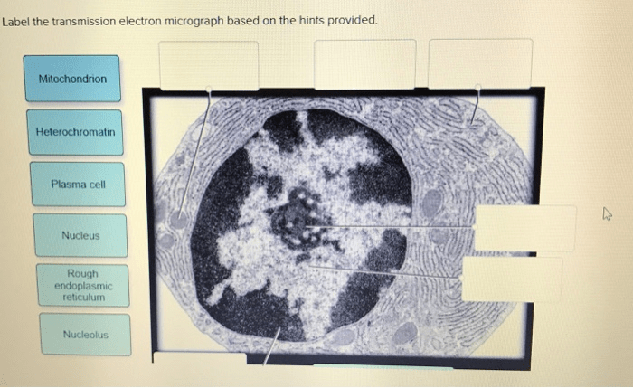 Prokaryotic cells ib biology electron coli micrographs ultrastructure cell drawing notes binary structures prokaryotes wall bio fission micrograph membrane may