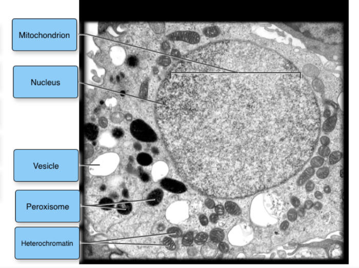 Label the transmission electron micrograph of the cell